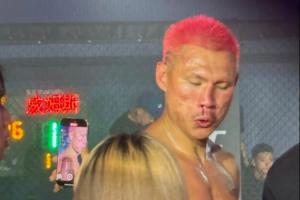 骨折了？惡鼠被威姆斯一拳打到面門！鼻梁已經(jīng)出現(xiàn)嚴(yán)重歪斜！