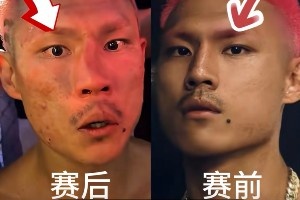 慘遭“整容”！惡鼠遭威姆斯TKO 鼻梁骨被打歪鮮血直流