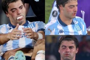 被打懵了！羅霍解放者杯不慎肘擊誤傷隊友，后者眼部腫了鼻子流血