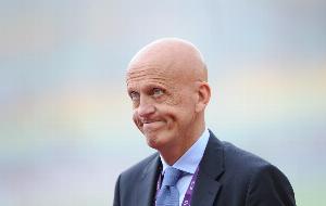 名哨科里納：我24歲時在15天內掉光頭發，后來禿頭成了我的標志