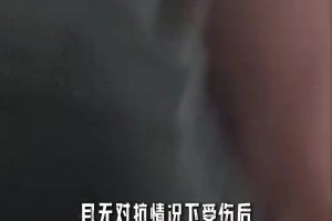 仰天長嘆！阿諾德開場就傷退，現(xiàn)場露出了悲傷無奈的表情