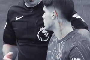 鐵血硬漢氣質！戰損版內托的“狠人”時刻！真的帥啊！